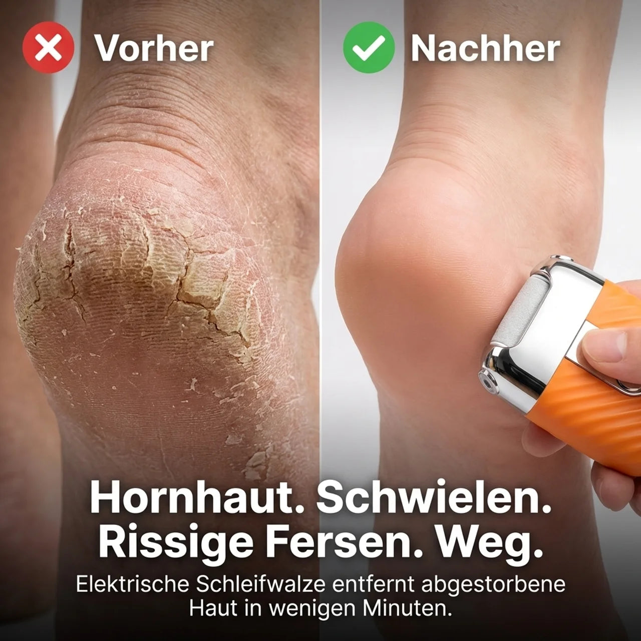 SmoothFoot – Elektrischer Hornhautentferner mit LED Display