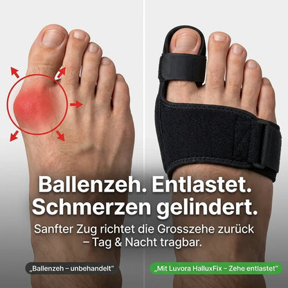 Hallux Valgus Korrektor – Verstellbare Schiene gegen Ballenzeh & Fußschmerzen | Tag & Nacht
