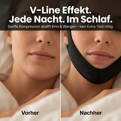 SlimBand – Kinnband gegen Schnarchen Schlafmaske